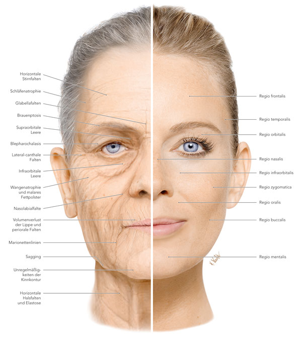 Faltenunterspritzung Und Faltenauffullung Gesichtsmodellierung Kosmetikconcept